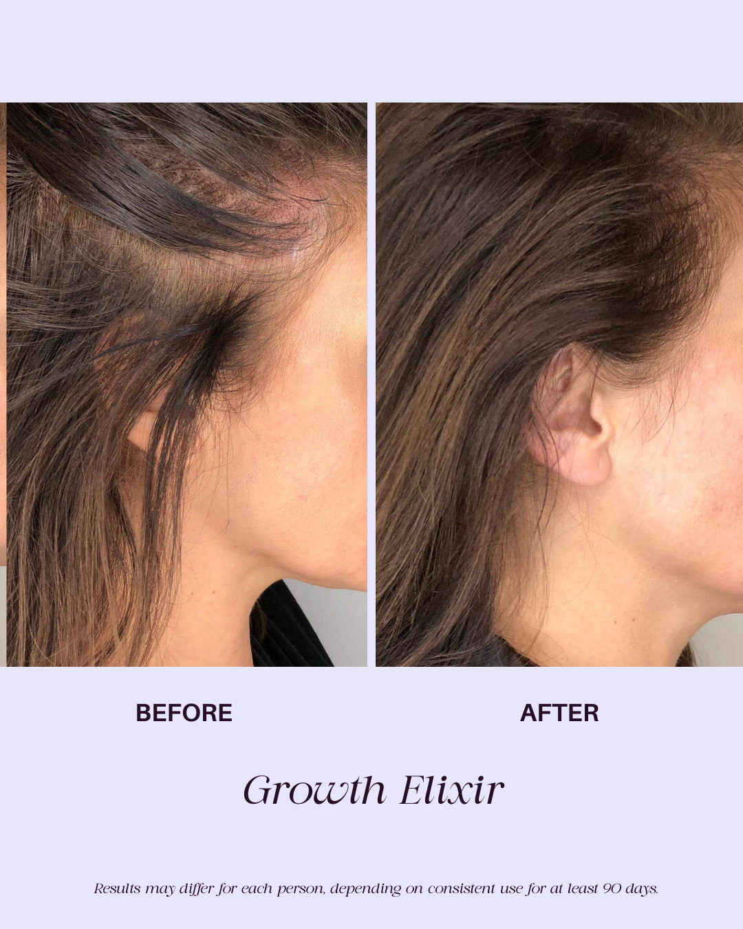 Growth Elixir | Botanical Hair Serum